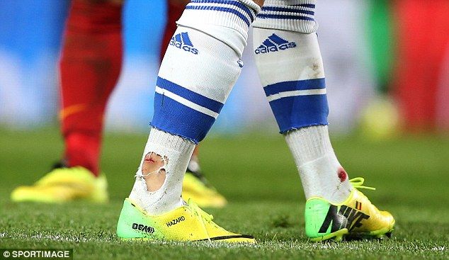 Eden Hazard's Achilles after 20 mins vs Slavia Prague (fouled twice by Kudela) : r/soccer